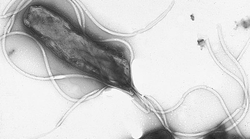 Helicobacter pylori.